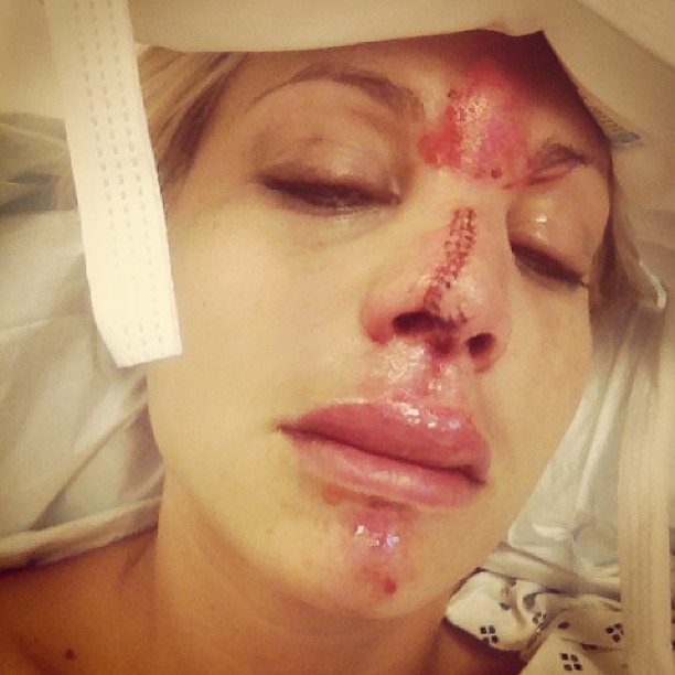 lisa-damato-face-accident